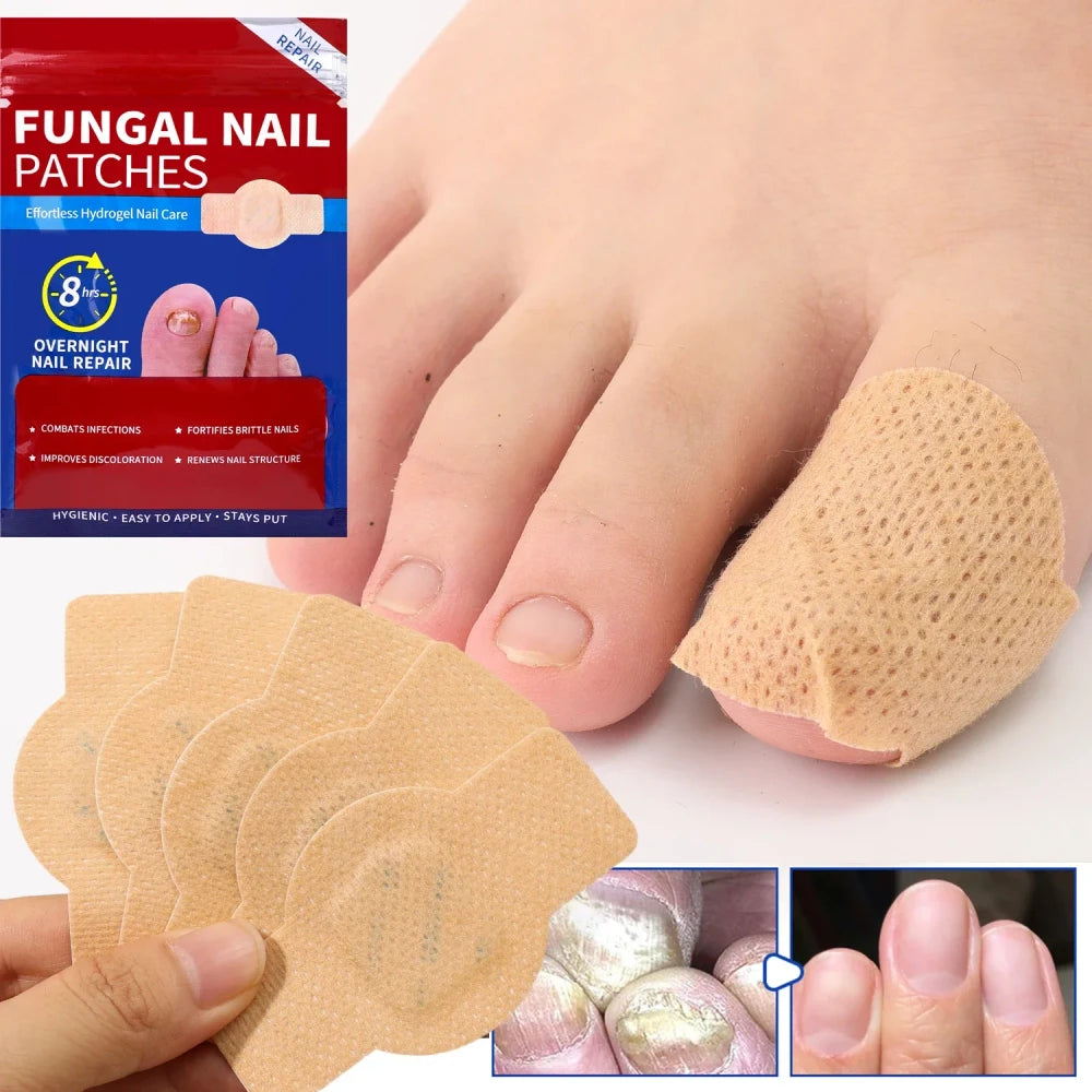 Waterproof Toenail Correction and Repair Patches