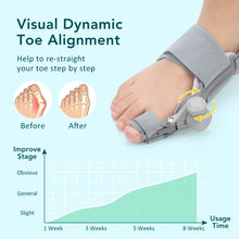 Adjustable Orthopedic Bunion Corrector