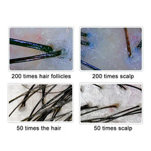 Digital Scalp and Hair Analyzer