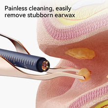 Smart Visual Ear Cleaning Tool