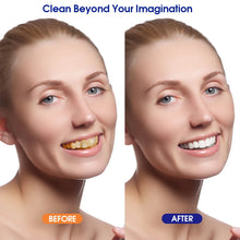 Electric Tooth Calculus Remover Sonic Dental Scaler Oral Irrigator Household Teeth Stains Tartar Tool Teeth Whitening Cleaner